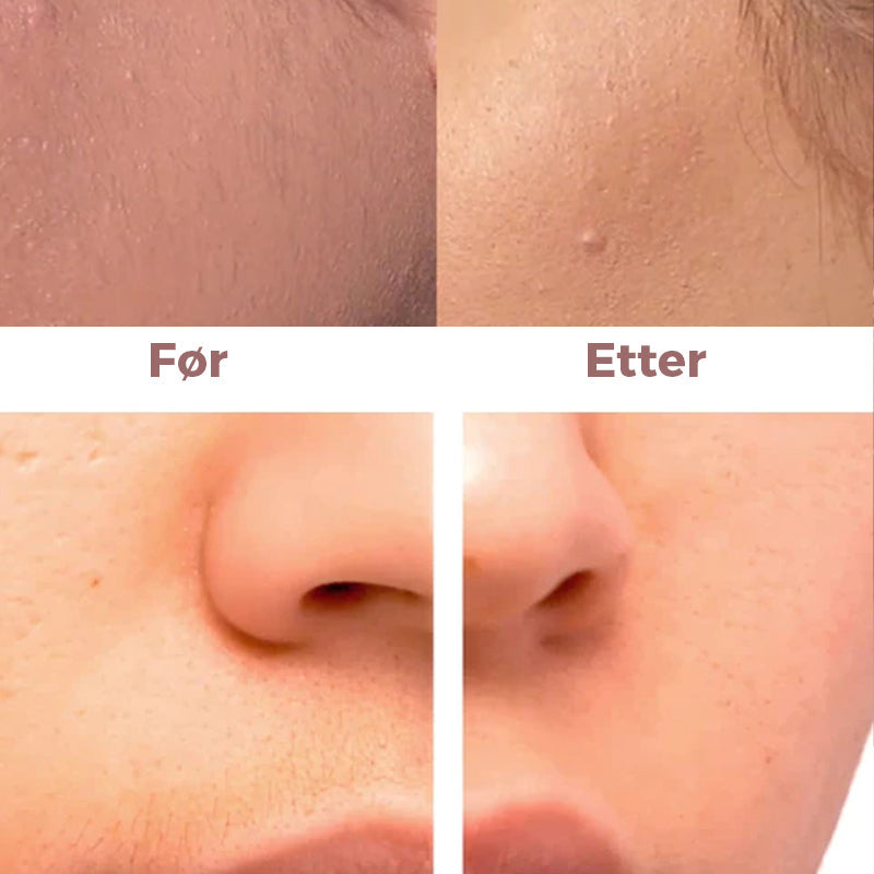 "Elegant ansiktsepilator i leppestift-stil for smertefri hårfjerning, tilgjengelig i hvit, svart og rosa gull."
