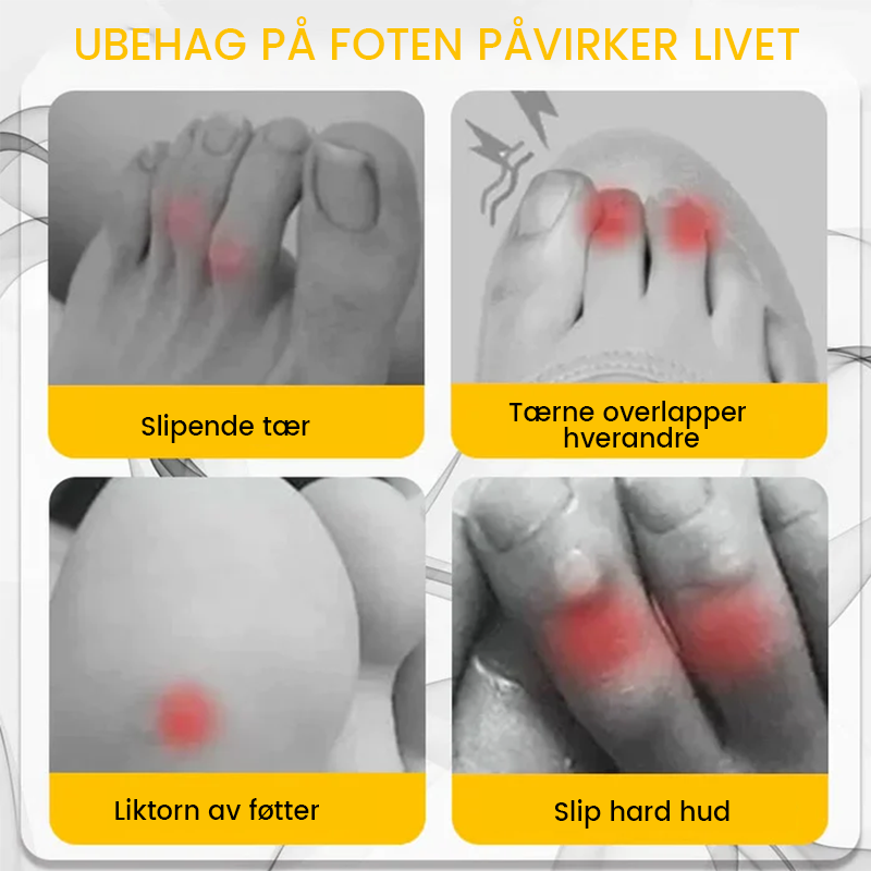 Gjennomsiktig silikon tåbeskytter gir anti-friksjonskomfort; elastisk, myk demping for smertefrie tær i åpne sko.