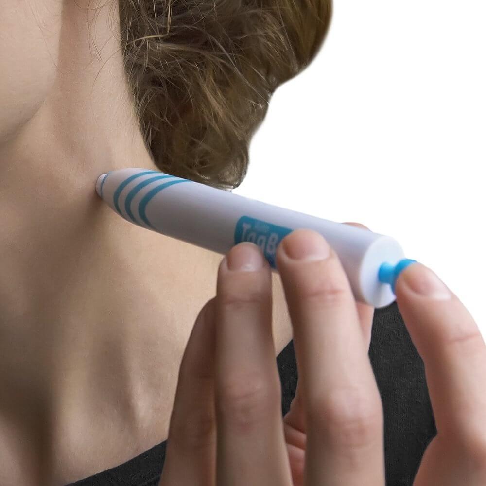 Komplett hudtaggfjerner kit for smertefri fjerning av hudtagger, raske resultater