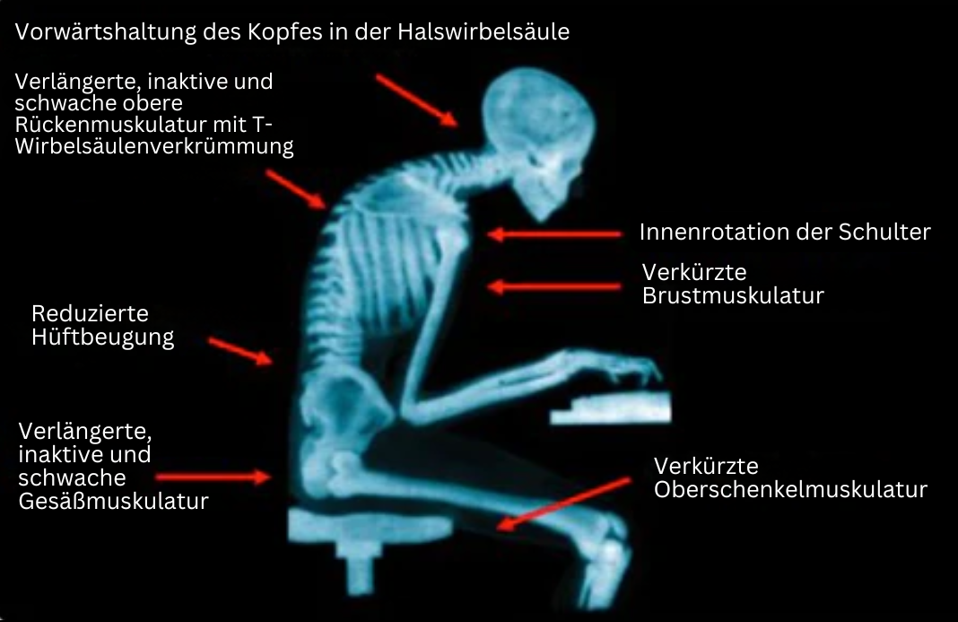 Kvinne bruker komfortabel holdningskorrigerer med EMS-teknologi under klærne, forbedrer holdning diskret