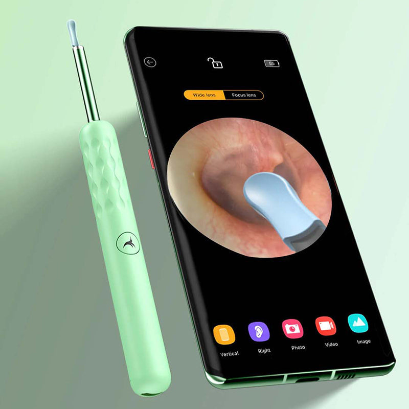 "Ørerens med kameraendoskop, 1080P oppløsning, viser øregangen detaljert for nøyaktig ørehygiene, portabel med WiFi."